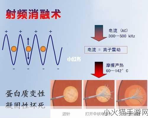 433MH2射频对人体有影响吗-1. ＂探讨433MH2射频对人体健康的潜在影响